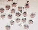 Eggs after retrieval