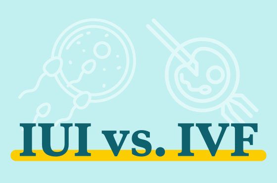 IUI vs IVF: Which fertility treatment is right for you?